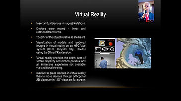 Personalised Cardiac Surgery with augmented and virtual reality augmentationRPK Cardiac Trial Digital (3)